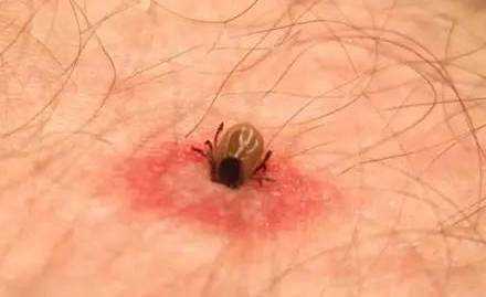 意外险理赔案例男子被毒虫咬伤买的50万意外险被拒赔了保险公司没法赔